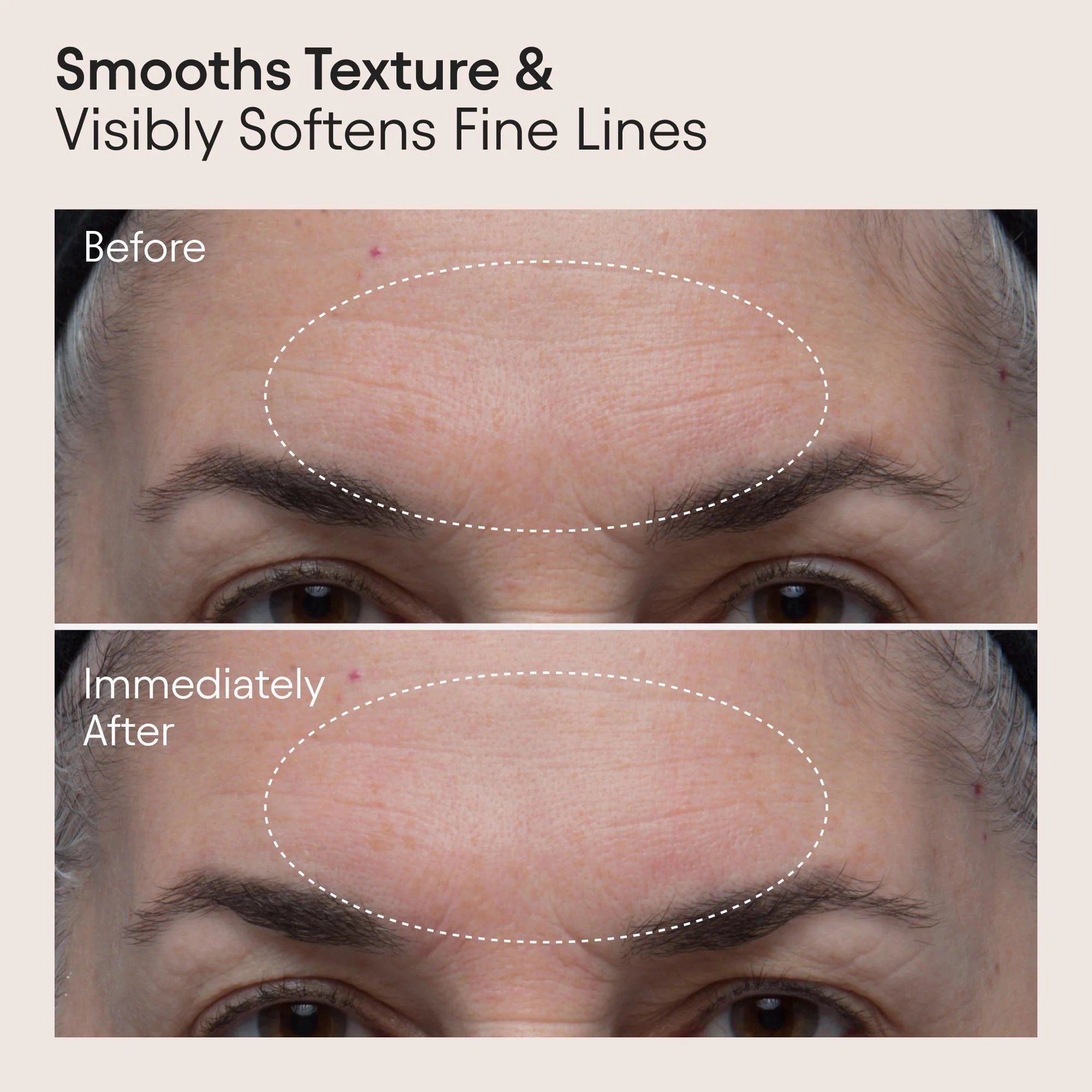 8 Acid Double Polishing Peel