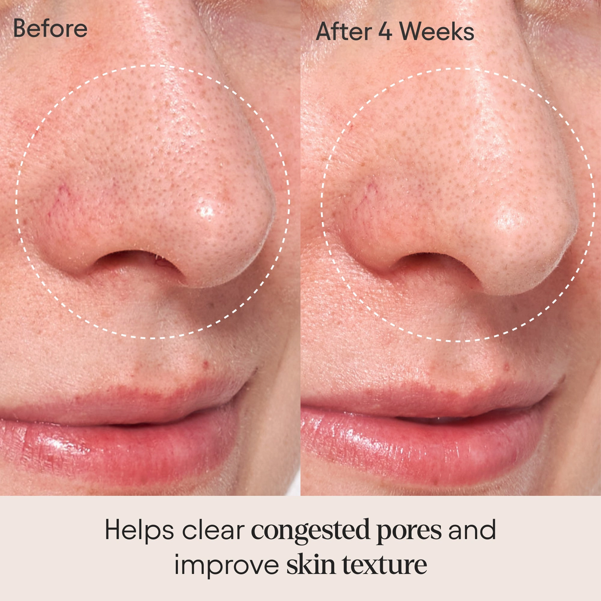 Clarifying Facial Oil