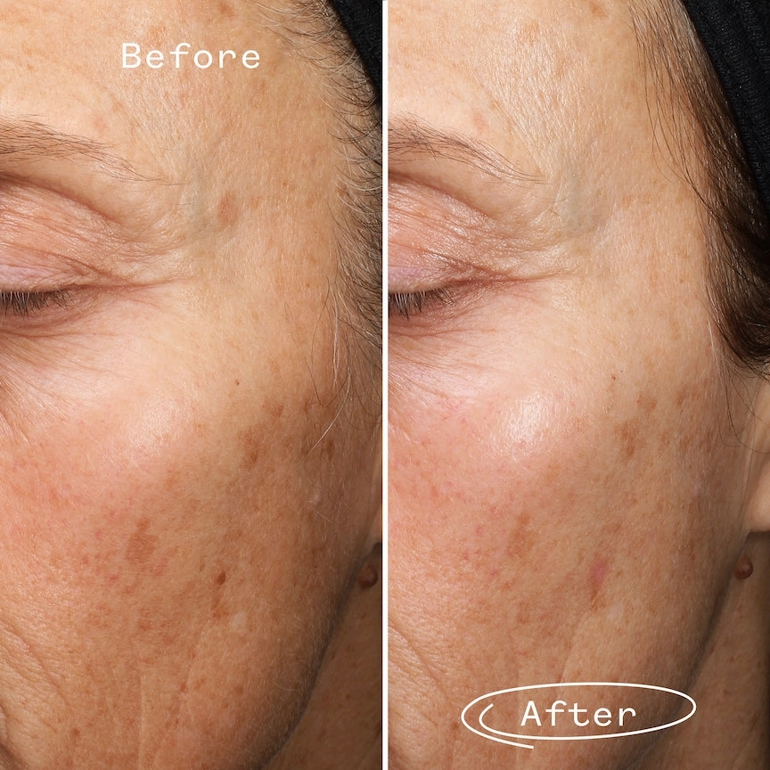 Fade Forward Dark Spot Serum