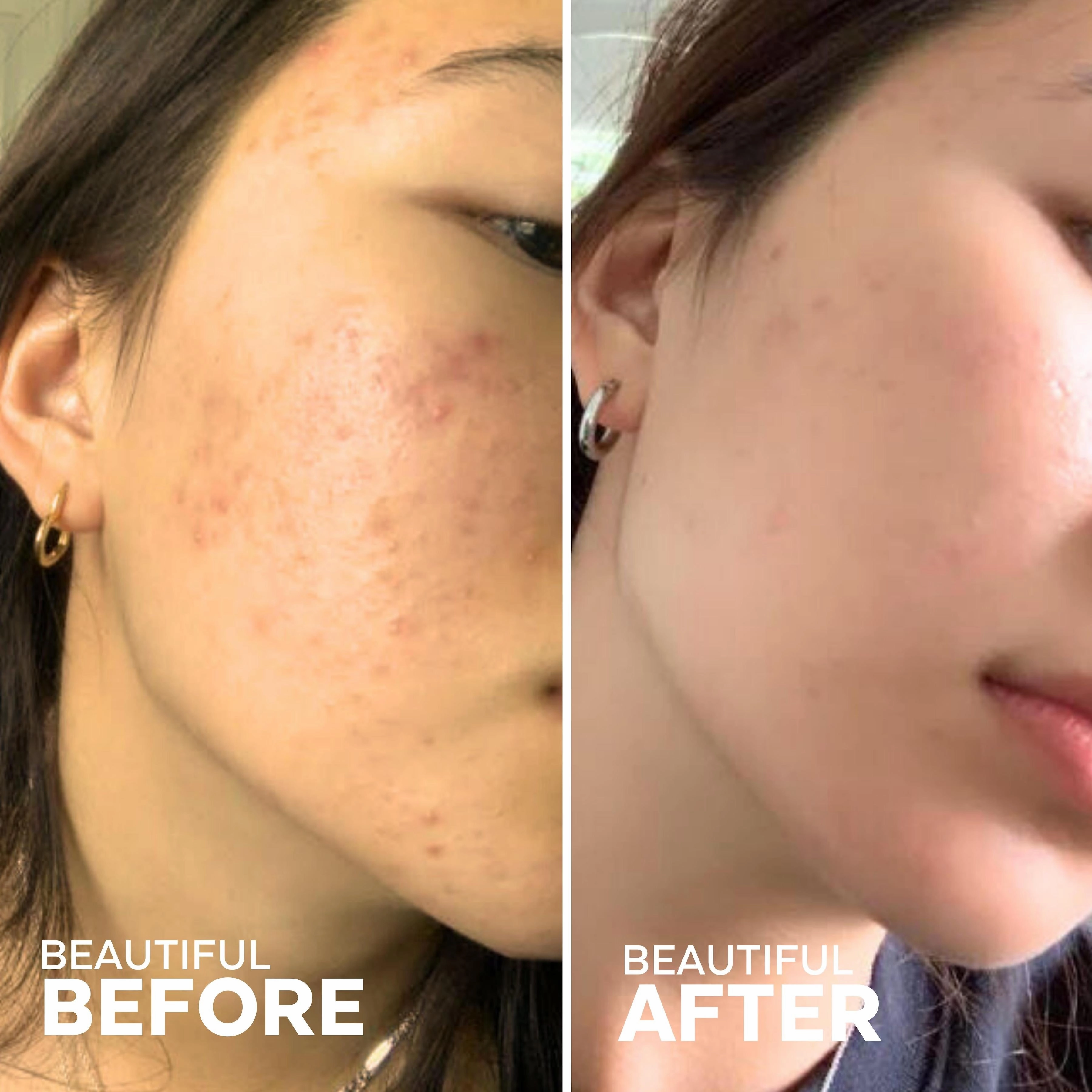 Purify Aloe   Amino Acid Cleanser